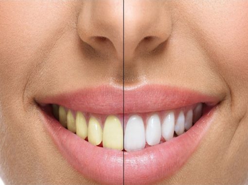 Estetica dental